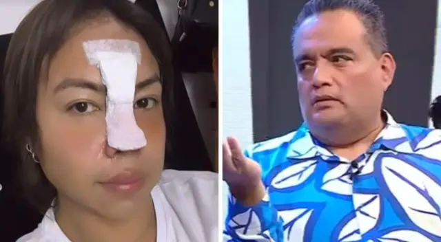 Dayanita JUSTIFICA su operación de nariz en medio de MILLONARIA deuda a Jorge Benavides: “Se me veía feo” Dayanita JUSTIFICA su operación de nariz en medio de MILLONARIA deuda a Jorge Benavides: “Se me veía feo”