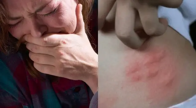 El INS alerta sobre un incremento en las mordeduras de araña casera durante la temporada de invierno.