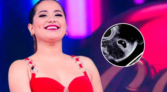 Ana Lucía Urbina publicó una curiosa instantánea de una ecografía en redes sociales ¿Está embarazada nuevamente?