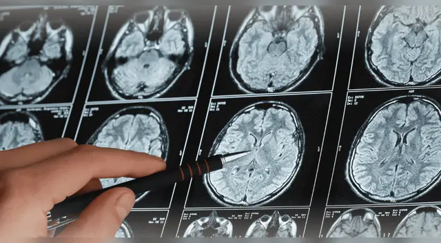 Científicos de Londres identifican la señal cerebral que ayuda a entender nuestro entorno.