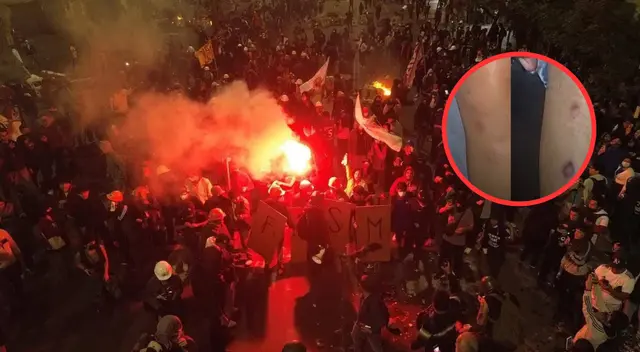 Periodistas resultan heridos por perdigones de la PNP durante protestas juveniles