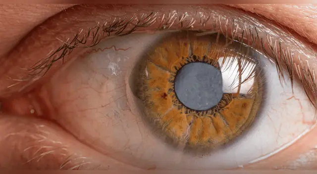 EMR: el tratamiento sin láser ni cirugía que podría cambiarlo todo. EMR: el tratamiento sin láser ni cirugía que podría cambiarlo todo.