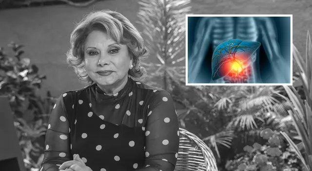 ¿De qué falleció Camucha Negrete y qué lamentable enfermedad padeció la actriz?