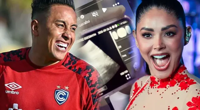 Christian Cueva deja en SHOCK al aparecer con una ECOGRAFÍA en medio de presunto embarazo de Pamela Franco Christian Cueva deja en SHOCK al aparecer con una ECOGRAFÍA en medio de presunto embarazo de Pamela Franco