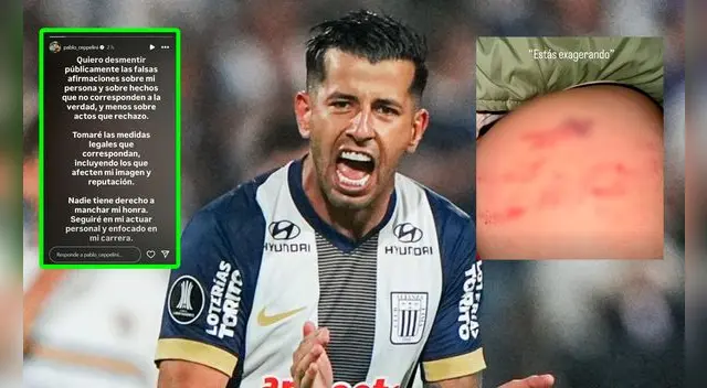 Pablo Ceppelini se pronunció en sus redes sociales tras ser denunciado por agresión. Foto: composición EP Pablo Ceppelini se pronunció en sus redes sociales tras ser denunciado por agresión. Foto: composición EP