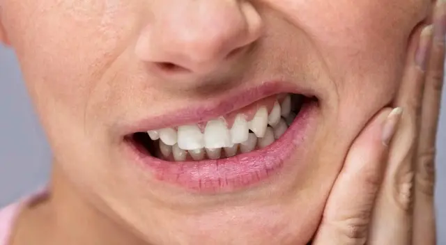 Descubre los alimentos que dañan tus dientes