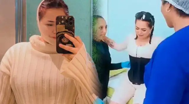 Ana Lucía Urbina, de Corazón Serrano, se sometió a cirugía estética y revela su proceso: "Drenajes linfáticos"
