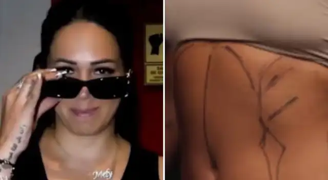 Melissa Klug CONFIESA los verdaderos motivos de sus recientes cirugías estéticas tras romper con Jesús Barco