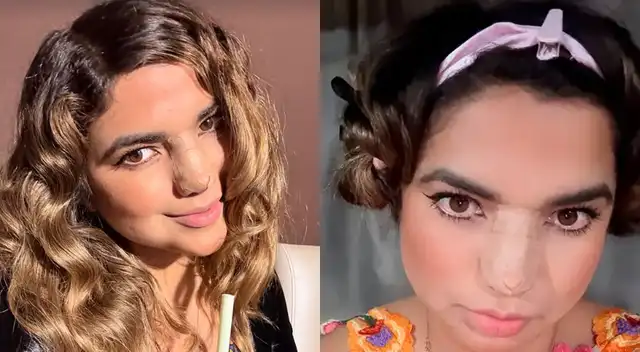 Susana Alvarado reapareció y compartió algunas fotos de su operación.