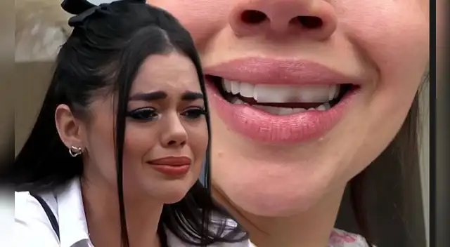 Natalia Segura preocupa tras anunciar que parte de su carilla dental se rompió.