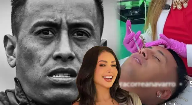 Christian Cueva deja EN SHOCK al someterese a INTERVENCIÓN en el rostro y sorprende con resultados: "Cueva más guapo" Christian Cueva deja EN SHOCK al someterese a INTERVENCIÓN en el rostro y sorprende con resultados: "Cueva más guapo"