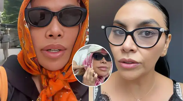 Amiga y doctora de Magaly 'PARCHA' a los críticos y REVELA  el por qué sus labios lucen 'estirados'.