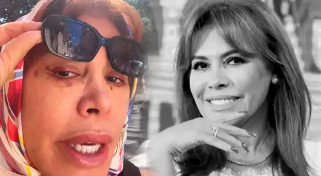 Magaly Medina muestra su rostro tras operación.