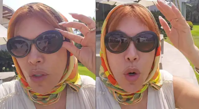 Magaly Medina reapareció y mostró cómo va su rostro luego de compleja cirugía.