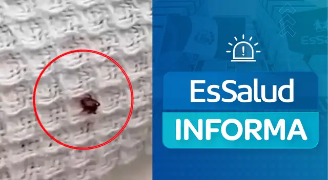 EsSalud se pronuncia tras indignante hallazgo de una garrapata en cama de hospital de Nuevo Chimbote.
