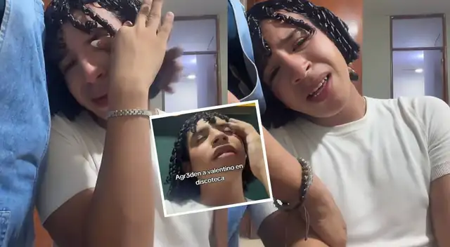 Valentino Palacios denuncia fuerte agresión contra él y su hermano.