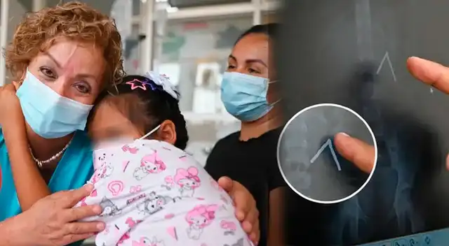 ¡IMPACTANTE! Pensaron QUE ERAN GASES, pero MÉDICOS revelan LO QUE EN VERDAD PASÓ con niña de 9 años