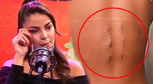 Laura Spoya compartió una foto de cómo está su cuerpo tras operación. Laura Spoya compartió una foto de cómo está su cuerpo tras operación.