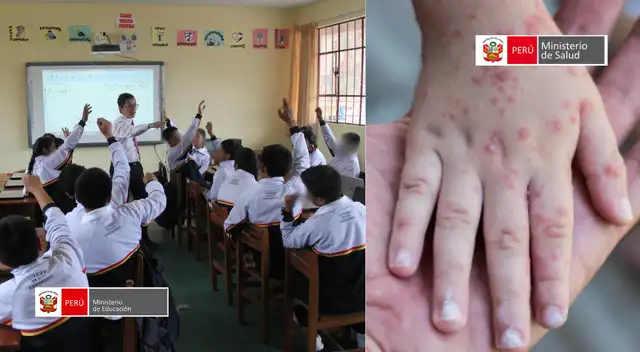 Minedu y Minsa activan protocolos ante aumento de casos del virus Coxsackie en colegios de Lima Metropolitana.