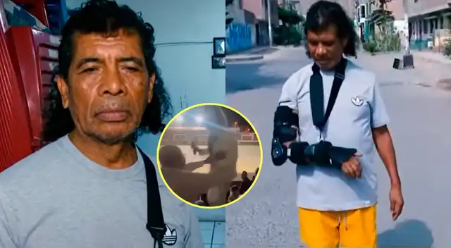 Chachay impacta al revelar las FUERTES secuelas que le dejó brutal agresión. Chachay impacta al revelar las FUERTES secuelas que le dejó brutal agresión.