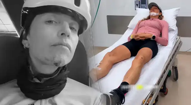 Anna Carina Copello se sincera sobre su accidente. Anna Carina Copello se sincera sobre su accidente.