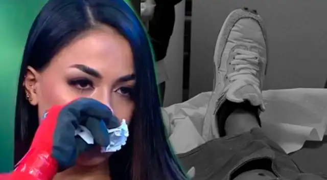 Onelia Molina sufrió accidente en la pierna.