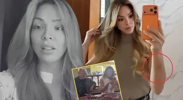 Sheyla Rojas se deja ver con moretones en brazos tras 'saliditas' con hombre investigado y aclara. Sheyla Rojas se deja ver con moretones en brazos tras 'saliditas' con hombre investigado y aclara.