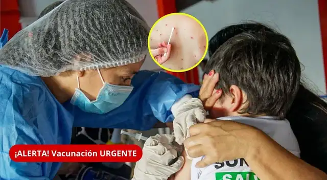 Alerta por sarampión en Perú: Minsa activa protocolos tras aumento de casos y revela las regiones con mayor riesgo.