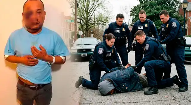 Hombre sufre lesión cerebral y hematomas luego de ser arrestado por el ICE.