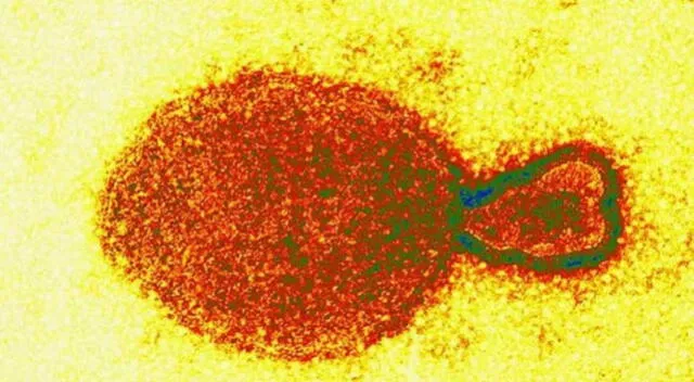  Los investigadores siguen trabajando para identificar mejor los orígenes del virus y cómo se propaga. Crédito: Captura Infobae. 