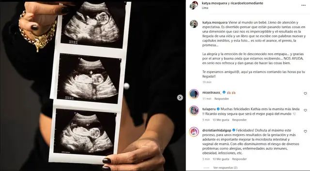  Katya Mosquera compartió las primeras ecografías de su próximo bebé con Ricardo Mendoza.