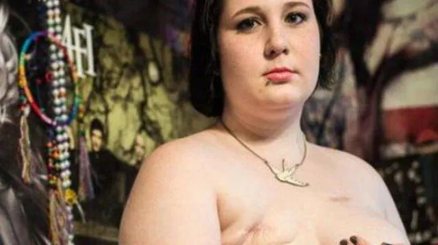 Facebook hace campaña contra el cáncer de seno con fotos de mujeres en topless tras mastectomía