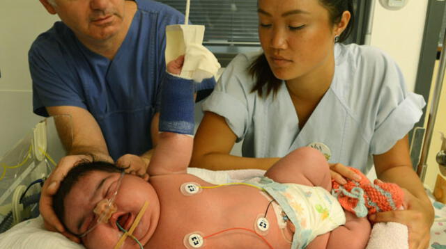 La bebé más grande del mundo nació en Alemania.