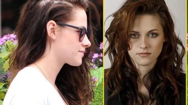 Kristen Stewart sufre un severo problema de caída de cabello