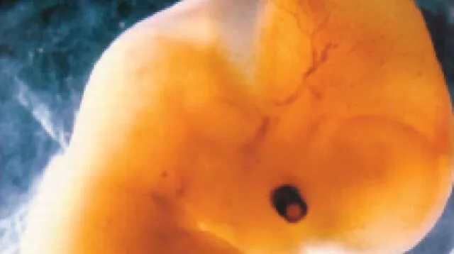 Embrión.