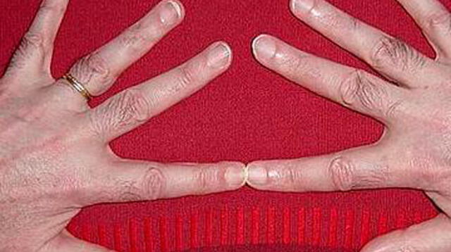 Los dedos y su relación con el cáncer de próstata.
