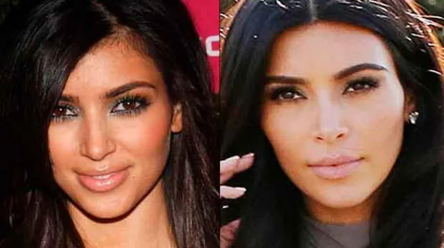 El antes y después de Kim Kardashian 