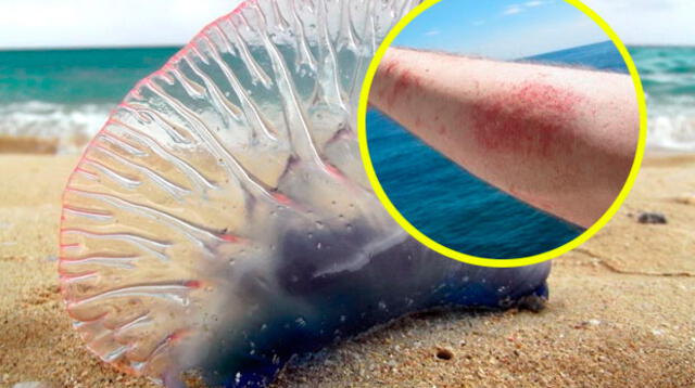 El verano en Lima se inició con brote de medusas.