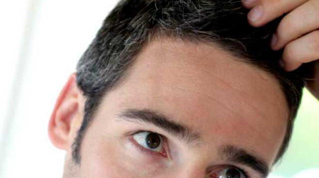 Las canas también aparecen en los jóvenes.