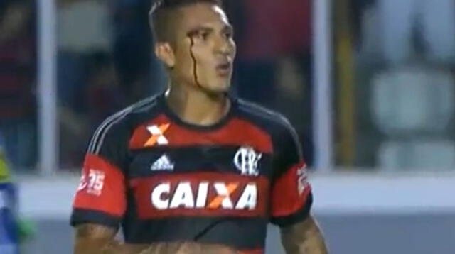 Paolo Guerrero y su corte en la cara.