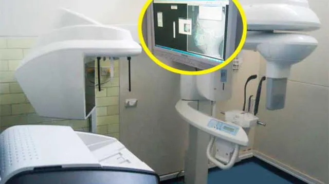 Nueva tecnología en el Hospital Sabogal