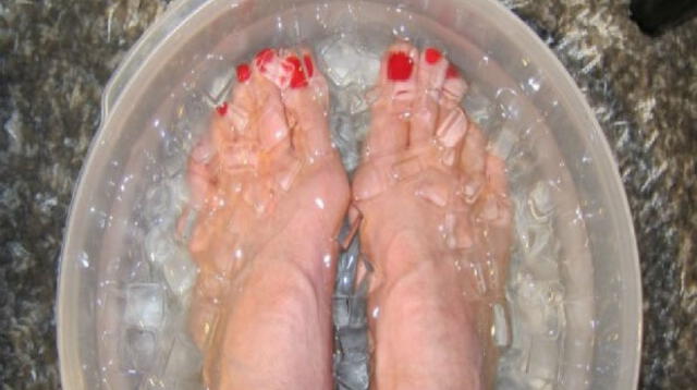 Descansa tus pies con hielo.