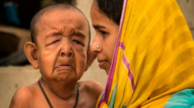 La madre llora desconsoladamente al no poder hacer nada por su hijo
