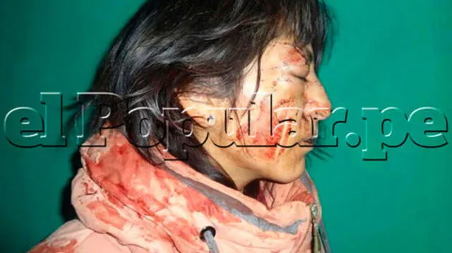 Policía captura a fiscal Luis Rodolfo Añamuro Machicao por golpear salvajemente a su esposa