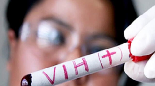 Alarmantes cifras del VIH en el Perú