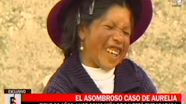 Mujer de 38 años luce como niña de 9 y está embarazada en Huancavelica