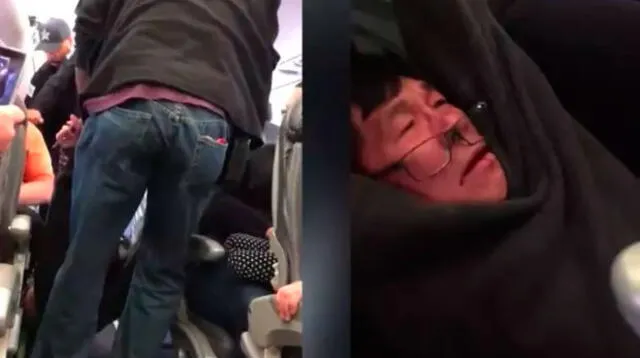 Así quedó pasajero de United Airlines tras sufrir paliza