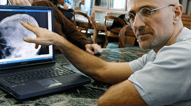 Sergio Canavero revolucionará la medicina con el primer trasplante de cabeza