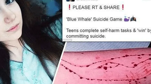 La 'ballena azul', el reto que pide a los participantes que se autolesionen y atenten contra su vida