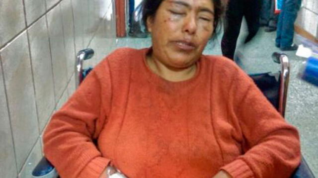 Poder Judicial de Arequipa dictó 4 meses de prisión preventiva contra reciclador que atacó a mujer con un taladro